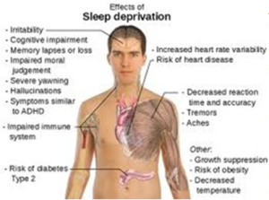 effects-of-sleep-deprivation